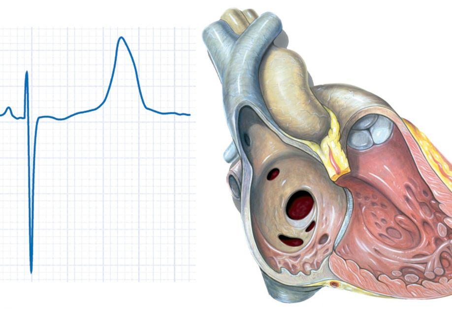 Αιφνίδιος θάνατος νέων καρδιά