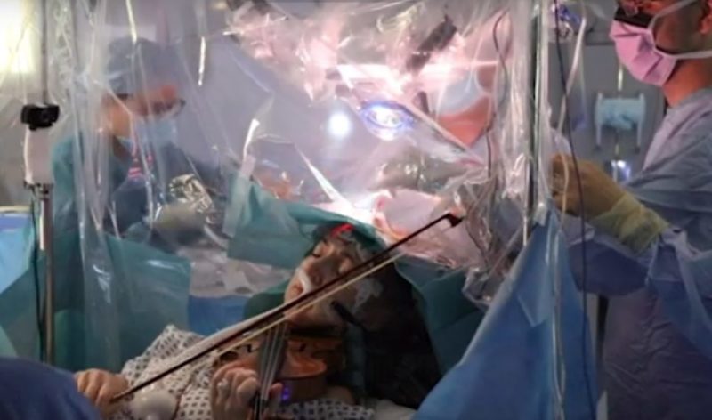 King's College βιολί εγχείρηση